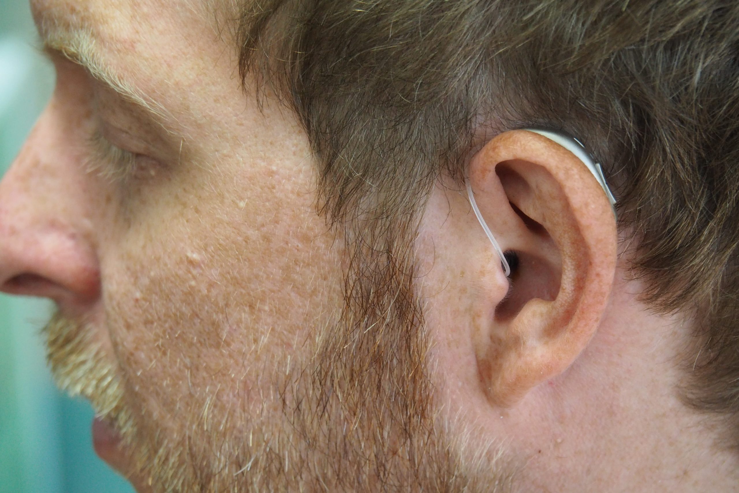 improving hearing loss 2022
